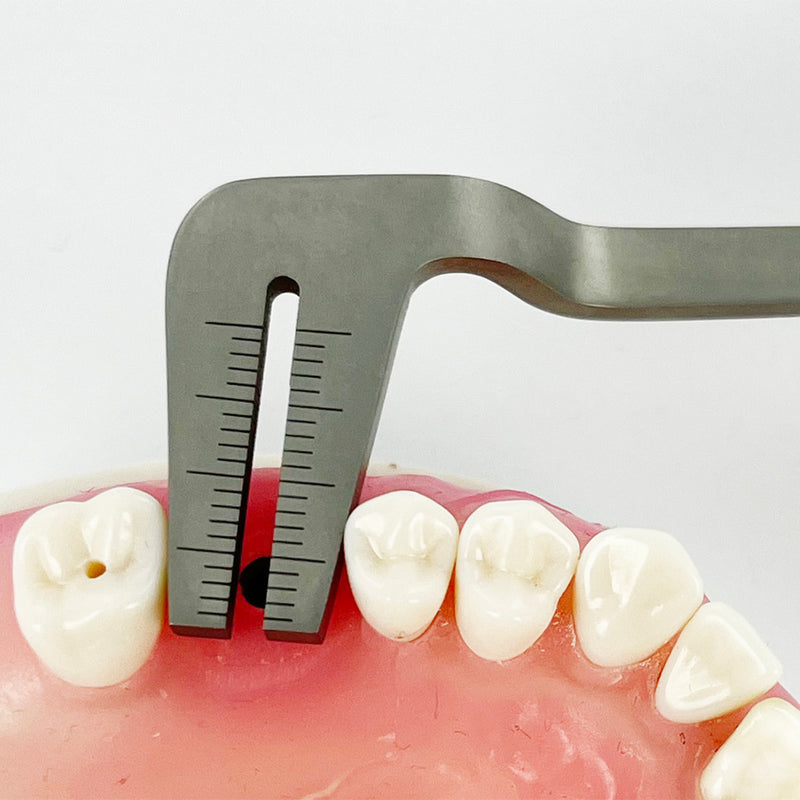 Posterior self-centering implant guide from Power Implant Guide Kit positioned between posterior teeth