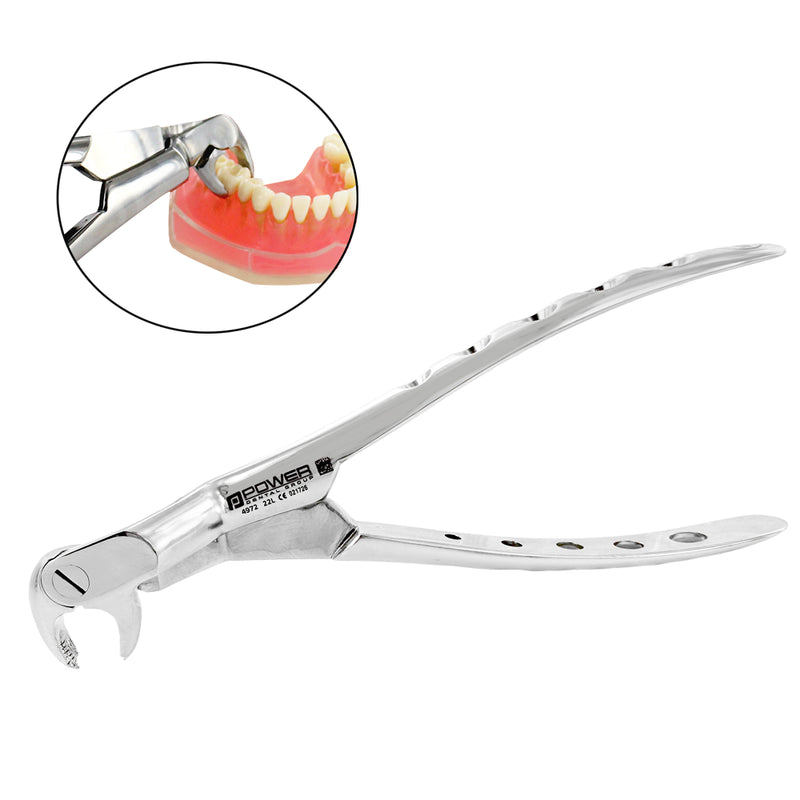 Power Extraction Forceps Kit #22 Molar, 45° Cross-Arch, Set of 2 - angled view of left forceps with clinical inset