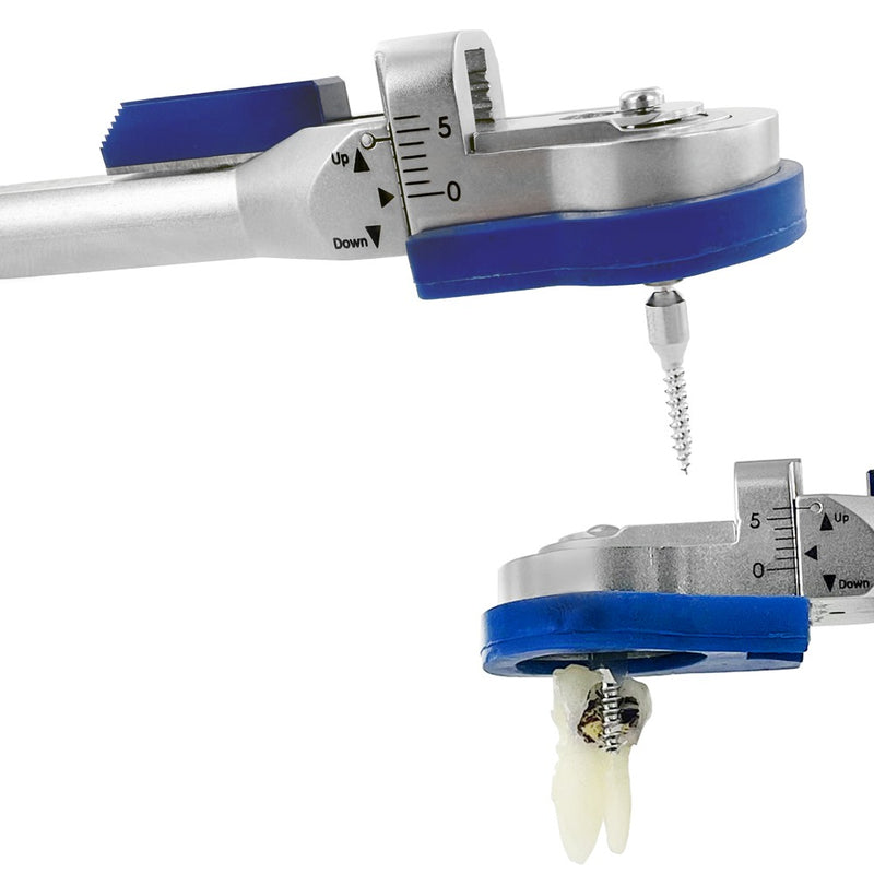 Power X Extractor Kit – Controlled Vertical Extraction System