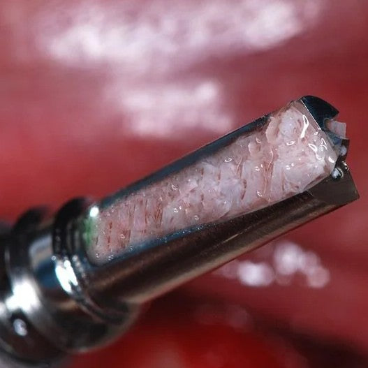 Bone Collector Drill with Protective Sleeve – 7.0 mm